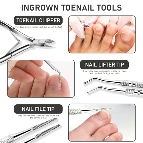 Ingrown Toenail Tool Kit, Ingrown Toenail Removal Kit: Ingrown Toenail Clippers, Ingrown Toenail File and Lifters, Under Nail Cleaner - Professional Pedicure Tools Set for Effective Treatment - color: Ingrown Toenail Clippers